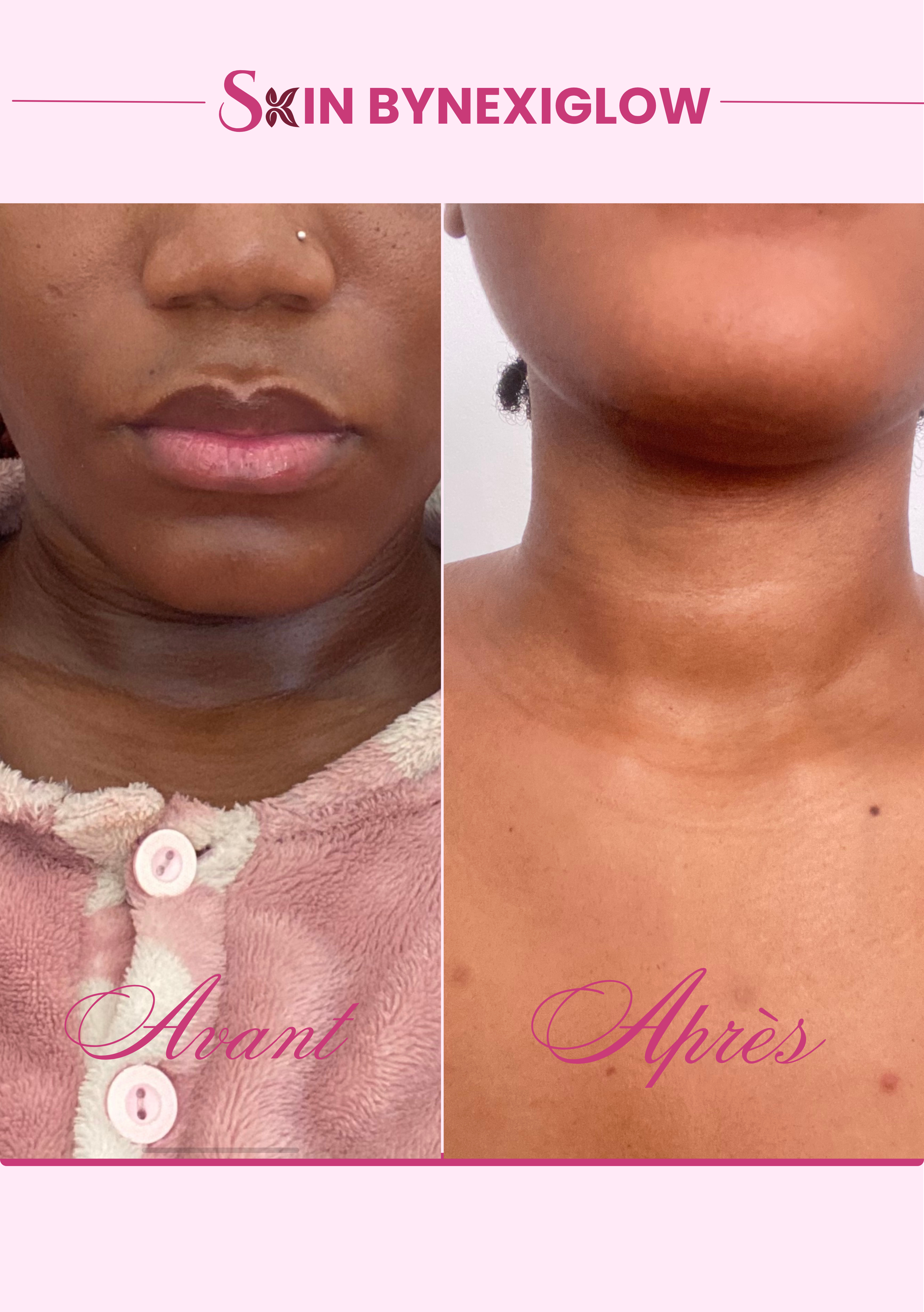 SAVON NOIR GLOW